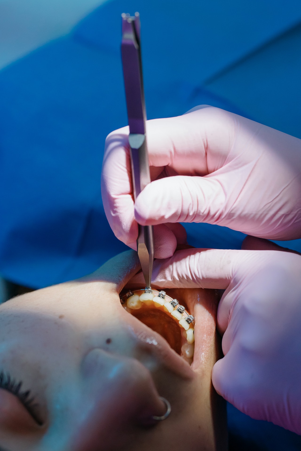 Common Myths About Cosmetic Dentistry Debunked
