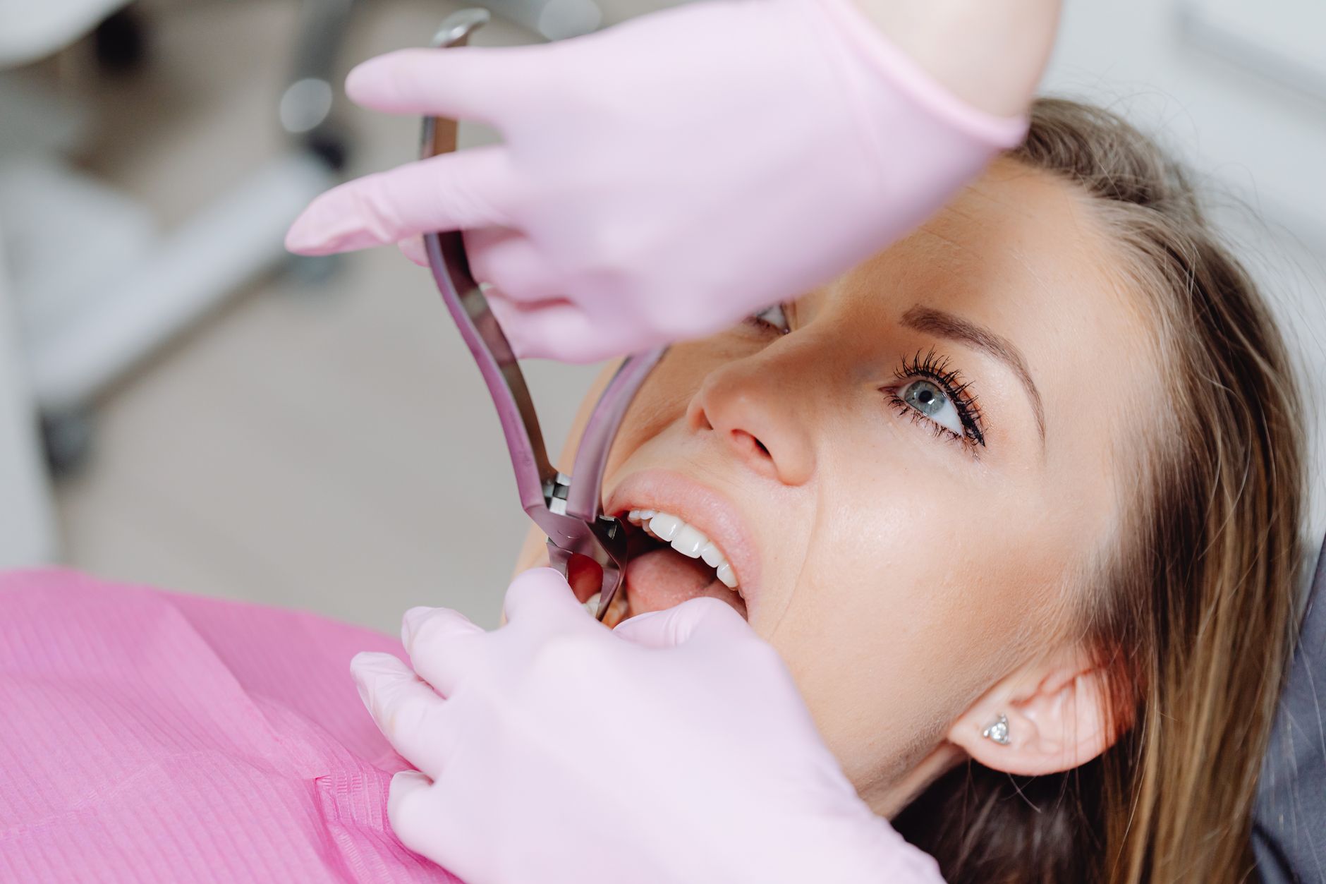 Understanding Recovery Time After Tooth Extraction in Martinez, CA