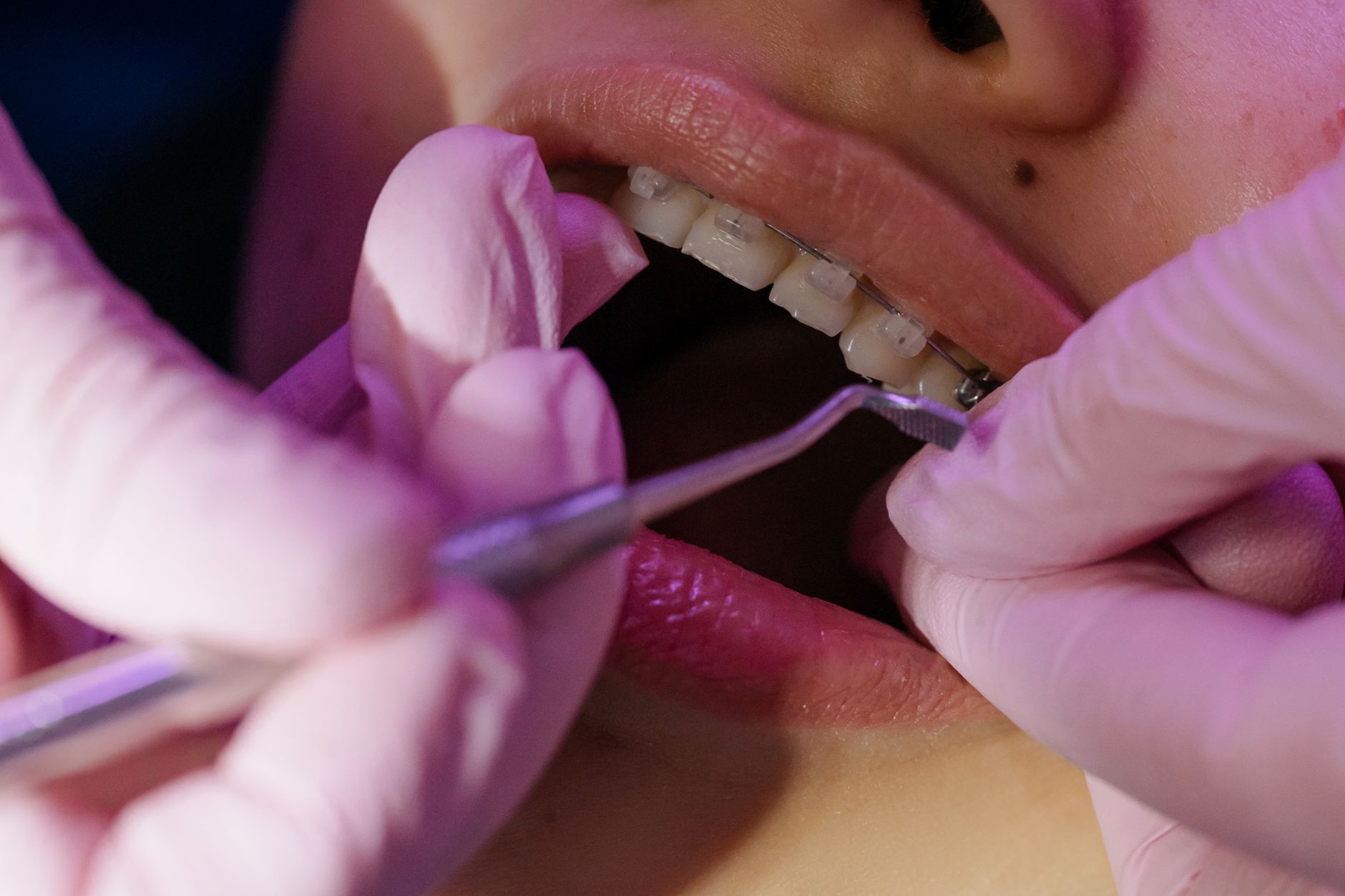 How to Prepare for Your Orthodontic Treatment Journey